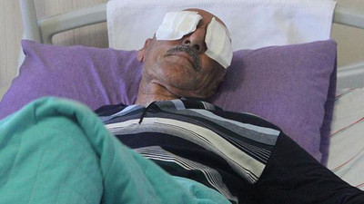 Kamyon kasasından çıktı gözlerini oydu !