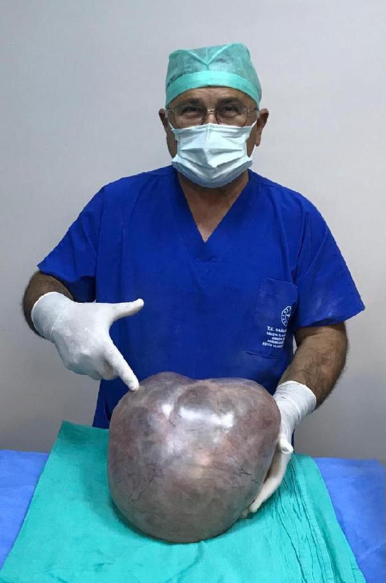 Hamile olduğunu sanıyordu... Gerçek çok başka çıktı - Resim: 1