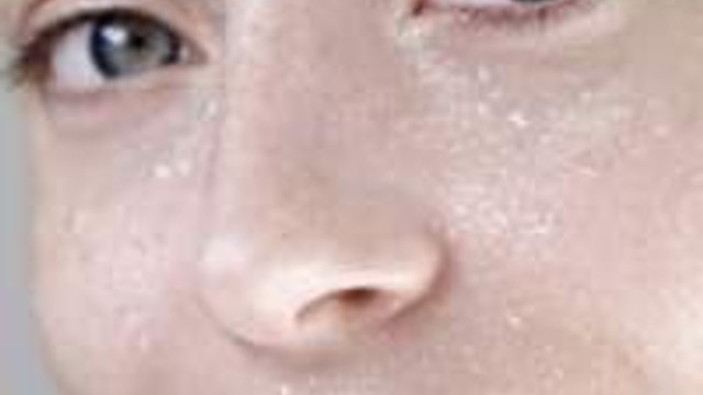 sebebi fazla et tuketimi ve tatli