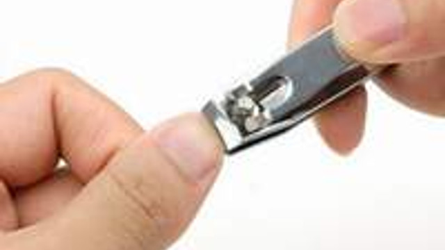 derin kesilen tirnak bakin basiniza