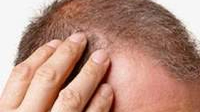 ekimi hakkinda bilmek istedikleriniz