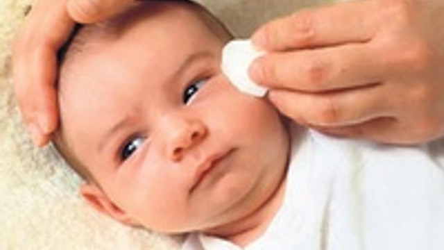 Bebeklerin Gozleri Neden Capaklanir Kadin