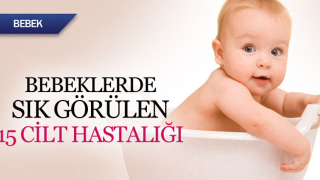 Bebeklerde Gorulen Cilt Sorunlari Nelerdir Bebek Com