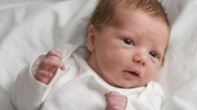 dogum lekesi fazlaysa dikkat kadin