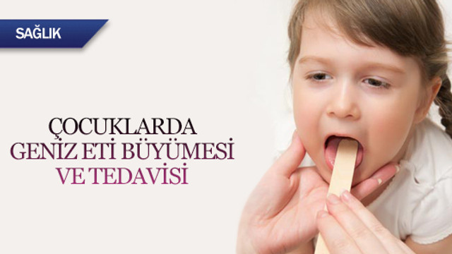 Cocuklarda Geniz Eti Buyumesi Ve Tedavisi Saglik