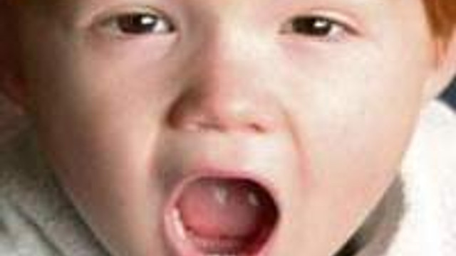 Kekeleme Sorunu Heceyle Cozuluyor Saglik