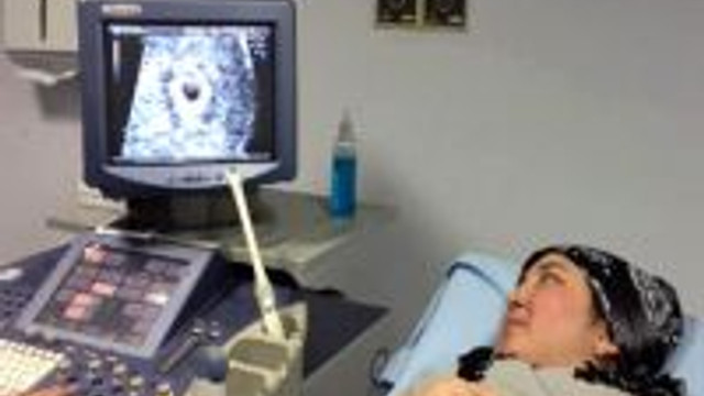 O Bebegin Kalp Atislari Izlendi Guncel