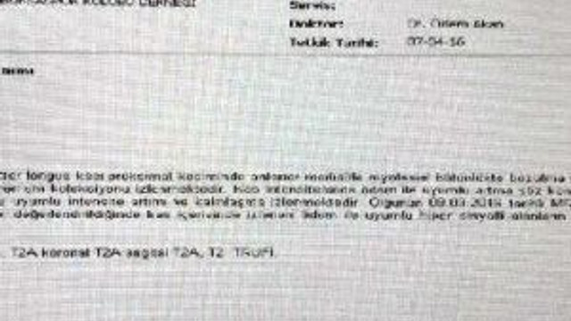 Bursaspor: Serdar Aziz İyileşmediği İçin Beşiktaş Maçında Oynamadı