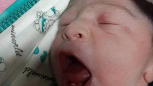 2 dişli doğan bebek şaşırttı