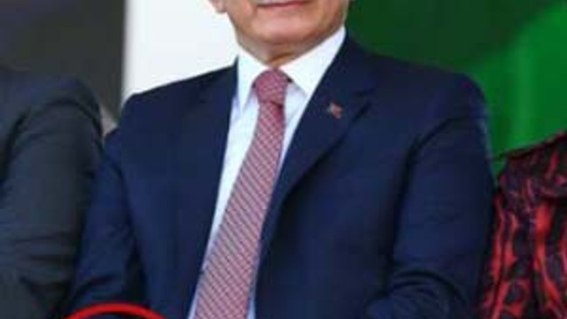 Davutoğlu'nun elindeki sargının nedeni bellli oldu