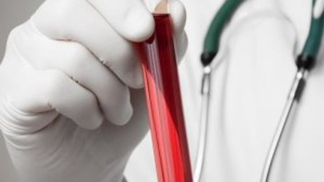 Türkiye'de AIDS hastalığı çoğaldı...