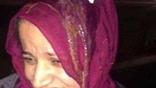ABD'de başörtülü kadına yumurtalı saldırı