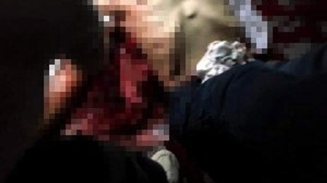 Bu sefer eşi, kocasını bıçakladı