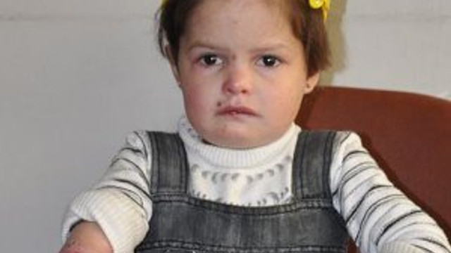'Anne benim parmaklarım ve saçım niye yok'