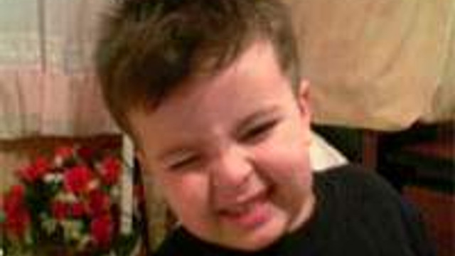 Atesliyken Terlemek Zararli Saglik