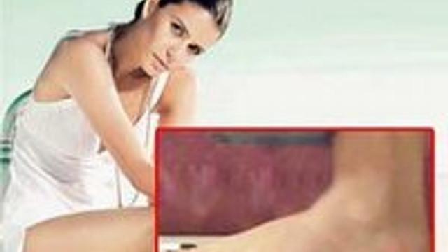 Beren altı parmaklı !