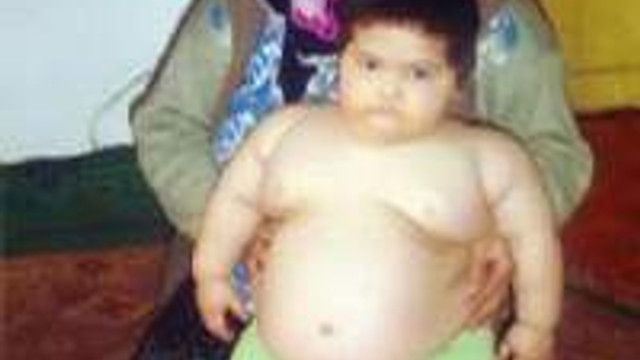 3 Yasinda Ama 40 Kilo Guncel