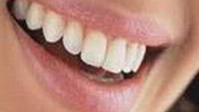 Gerdek Korkusu Kekeme Yapiyor Saglik