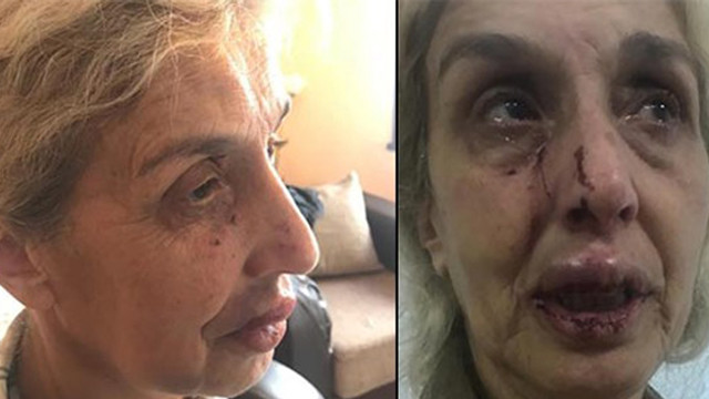 Tek isteği sokak hayvanlarını beslemekti