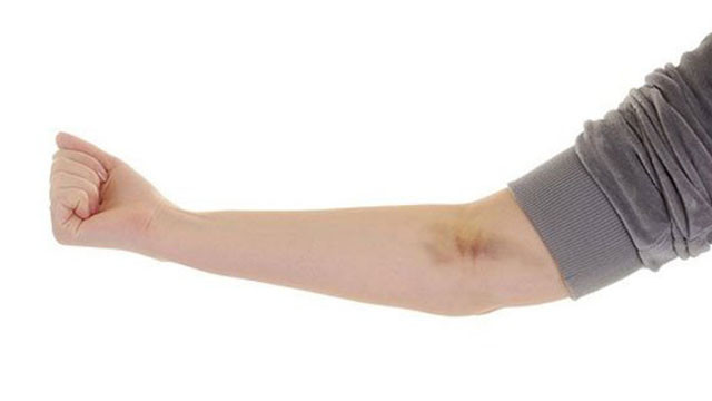 morluk nedenleri saglik