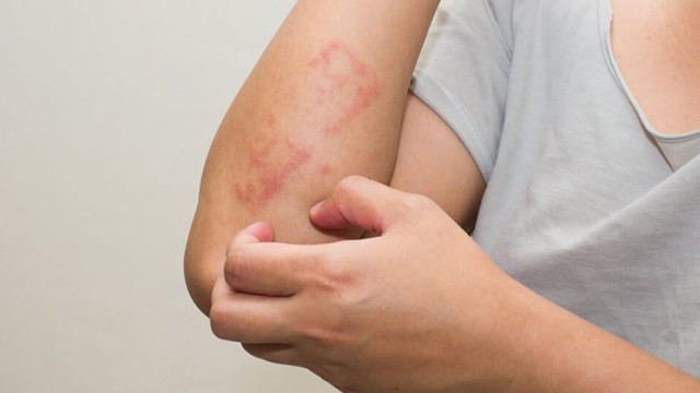 kasinti belirtileri saglik