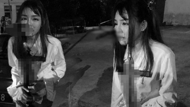 Kapkaççı kendisine direnen genç kadını yüzünden bıçakladı