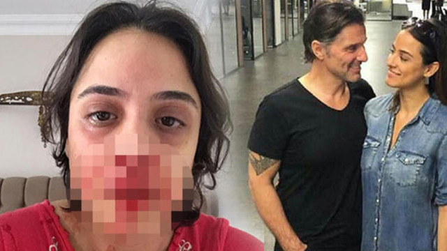 Sevgilisini döven Hazım Körmükçü diziden kovuldu