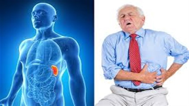 dalak buyumesi nedenleri saglik