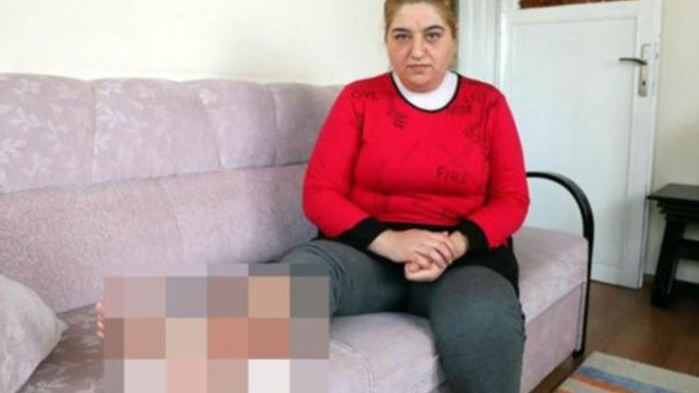 Sivilce yüzünden bacağı kesilecek
