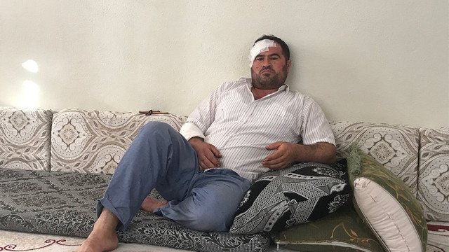 Akçakale'deki havan saldırısında yaralanan vatandaş: Gerekirse ölürüz