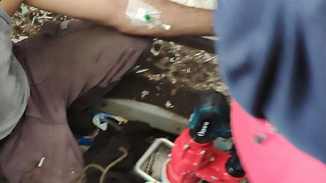 Bacağı çöp öğütücü makineye sıkıştı !
