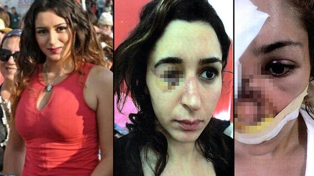23 yaş küçük sevgili ayrılmak isteyince kabusu yaşattı