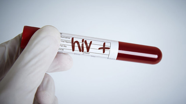 Türkiye'de yeni tehlikenin adı, HIV! 5 yılda %400 arttı