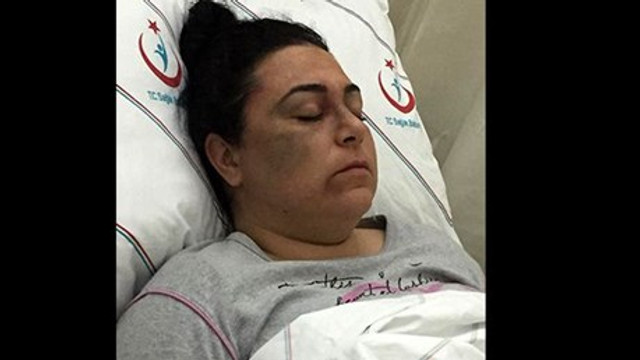 Yolda yürüyen 3 kadına saldırdı, ''Birine benzettim'' deyip serbest kaldı