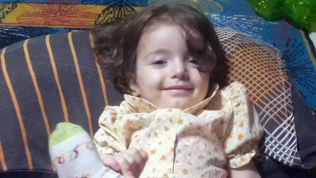 Esma bebek yaşam savaşını kaybetti