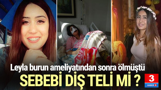 Buyuk Suphe Leyla Dis Telinden Mi Oldu Guncel