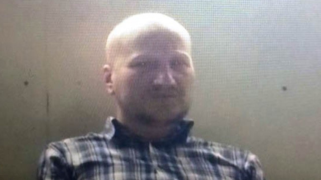 kesik bacak ile ilgili görsel sonucu