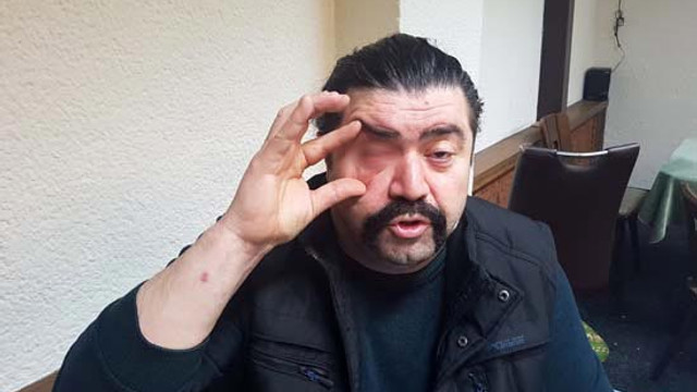 Asker eğlencesinde maganda dehşeti! Gözünden oldu!