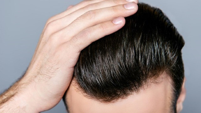 Sac Ekimi Nasil Dogal Gorunur Saglik