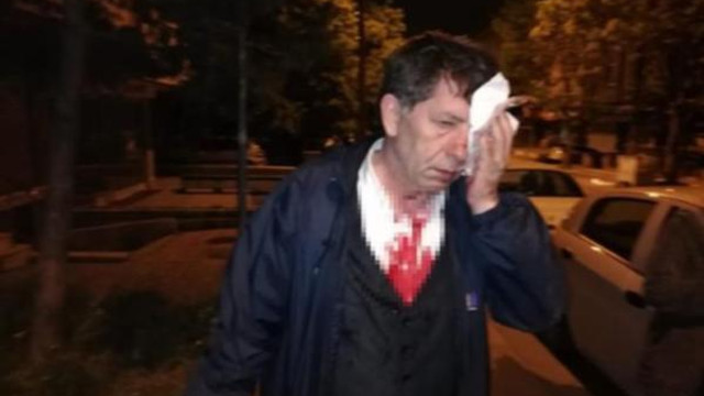 Saldırıya uğrayan gazeteci Demirağ'dan ilk açıklama