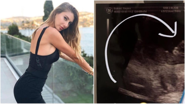 Şeyma Subaşı ultrason fotoğrafı paylaştı ortalık karıştı