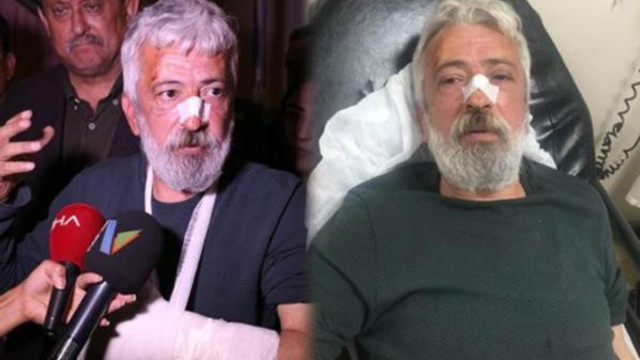 Gazeteciye saldıran MHP'li başkanın şoförü çıktı