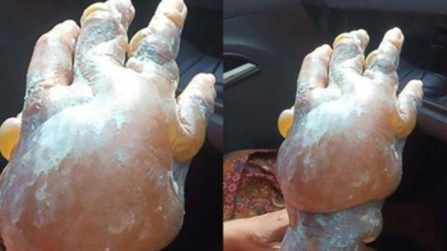 Yanan yere sakın bunları yapmayın !