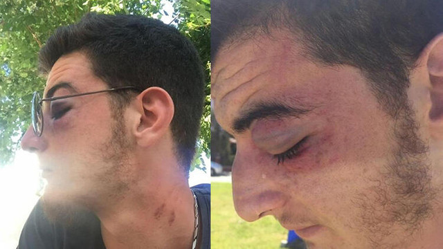 Festivalde dehşet ! Güvenlik görevlileri darp etti iddiası