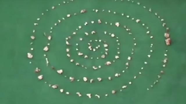 Çocuğun ağzından 526 adet diş çıkarıldı !
