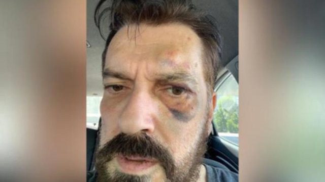 Sonar Arastirma Nin Sahibi Hakan Bayrakci Ya Saldiri Guncel