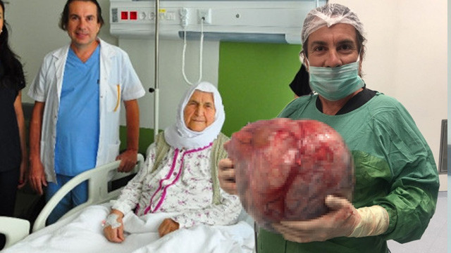 Kilo aldığını sandı ama... Karnından çıkana inanamadı !