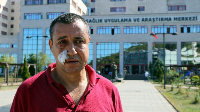 Terör gazisini asfalt yüzünden darp ettiler !