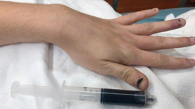 Doktorlar da şaşırdı ! Genç kadının kanı maviye döndü