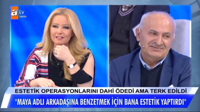 Sevgilisini diğer sevgilisine benzetmek için estetik ameliyat yaptırdı